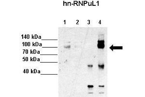 Immunoprecipitation (IP) image for anti-Heterogeneous Nuclear Ribonucleoprotein U-Like 1 (HNRNPUL1) (C-Term) antibody (ABIN2779021)