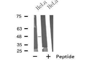 Western blot analysis of extracts from HeLa cells using SCTR antibody. (SCTR Antikörper  (Internal Region))