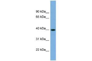 SAE1 antibody used at 1 ug/ml to detect target protein. (SAE1 Antikörper  (N-Term))