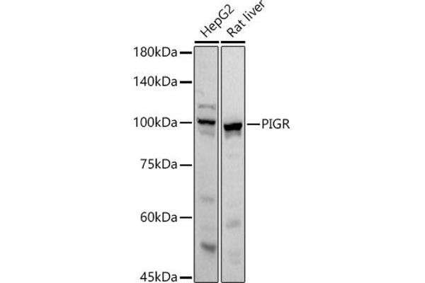 PIGR 抗体  (AA 661-764)