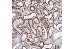 Immunohistochemical staining of human kidney with XPO6 polyclonal antibody  shows strong cytoplasmic positivity in cells of tubules.