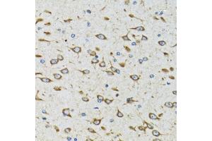 Immunohistochemistry of paraffin-embedded rat brain using AKTIP antibody (ABIN6131091, ABIN6136746, ABIN6136748 and ABIN6221837) at dilution of 1:100 (40x lens).