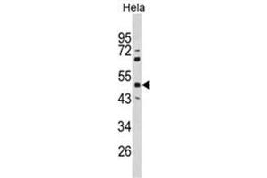 Western blot analysis of PAX6 Antibody (Center) in Hela cell line lysates (35ug/lane). (PAX6 Antikörper  (Middle Region))
