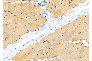 ABIN6262017 and ABIN6279469 at 1/100 staining Rat skin tissue by IHC-P. (GNG13 Antikörper  (N-Term))