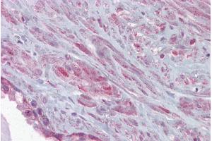 Immunohistochemistry with Prostate tissue at an antibody concentration of 5µg/ml using anti-KCNMA1 antibody (ARP35092_P050) (KCNMA1 Antikörper  (C-Term))
