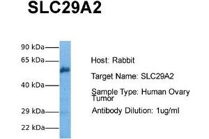 Host: Rabbit Target Name: SLC29A2 Sample Tissue: Human Ovary Tumor Antibody Dilution: 1. (SLC29A2 Antikörper  (C-Term))