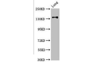 Western Blot Positive WB detected in: Rat kidney tissue All lanes: MAN2B2 antibody at 3. (MAN2B2 Antikörper  (AA 347-523))