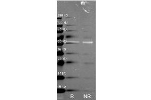Western Blot of Rabbit anti-Catalase antibody. (Catalase Antikörper)