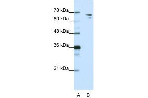 WB Suggested Anti-SF1 Antibody Titration:  1. (Splicing Factor 1 Antikörper  (N-Term))