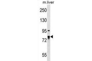 Western Blotting (WB) image for anti-La Ribonucleoprotein Domain Family, Member 4 (LARP4) antibody (ABIN2999557)