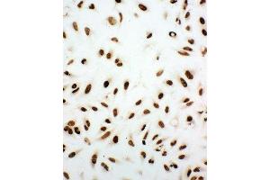 Immunohistochemistry (IHC) image for anti-X-Ray Repair Complementing Defective Repair in Chinese Hamster Cells 5 (Double-Strand-Break Rejoining) (XRCC5) (AA 648-662), (C-Term) antibody (ABIN3044235)