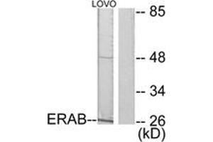 Western blot analysis of extracts from LOVO cells, using ERAB Antibody. (HSD17B10 Antikörper  (AA 111-160))