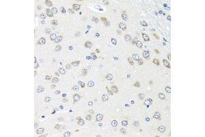 Immunohistochemistry of paraffin-embedded rat brain using PIAS3 antibody at dilution of 1:100 (40x lens). (PIAS3 Antikörper)