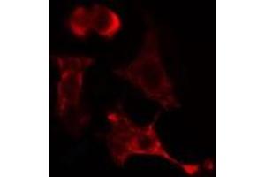 Immunofluorescence (fixed cells) (IF/ICC) image for anti-Protein Phosphatase, Mg2+/Mn2+ Dependent, 1L (PPM1L) (Internal Region) antibody (ABIN6259568)