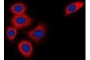 Immunofluorescent analysis of DOK1 staining in K562 cells.