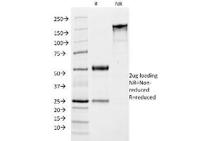 SDS-PAGE Analysis Purified Growth Hormone Monoclonal Antibody (SPM106). (Growth Hormone 1 Antikörper  (AA 58-187))