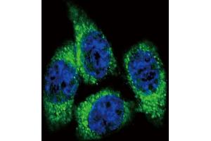 Confocal immunofluorescent analysis of CYP17A1 Antibody (Center) (ABIN392362 and ABIN2841999) with Hela cell followed by Alexa Fluor? (CYP17A1 Antikörper  (AA 358-388))