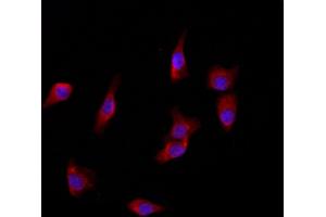 ABIN6266079 and ABIN6272868 staining HepG2 by IF/ICC. (YME1L1 Antikörper  (C-Term))