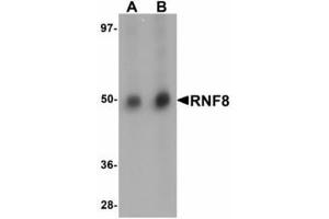 Image no. 1 for anti-Ring Finger Protein 8 (RNF8) (C-Term) antibody (ABIN478298)