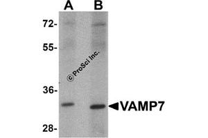 Western Blotting (WB) image for anti-Vesicle-Associated Membrane Protein 7 (VAMP7) antibody (ABIN1031804)