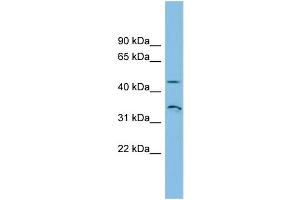 WB Suggested Anti-RHBG Antibody Titration: 0. (RHBG Antikörper  (N-Term))