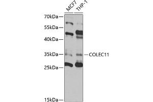 Western blot analysis of extracts of various cell lines, using COLEC11 antibody (ABIN6130117, ABIN6138854, ABIN6138855 and ABIN6220812) at 1:1000 dilution. (COLEC11 Antikörper  (AA 26-271))