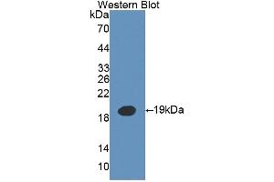 Detection of Recombinant IL3, Mouse using Polyclonal Antibody to Interleukin 3 (IL3) (IL-3 Antikörper  (AA 33-166))
