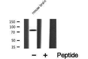 Western blot analysis of extracts from mouse Brian, using DCLK2 antibody. (DCLK2 Antikörper  (N-Term))