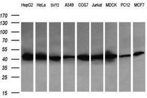 Image no. 5 for anti-Acetyl-CoA Acyltransferase 2 (ACAA2) antibody (ABIN1495727) (ACAA2 Antikörper)