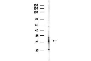 Western blot analysis of lysates from Hela cells(starvation,24h treatment), using RB Antibody at 1/1000 dilution.