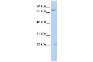 STRA6 antibody used at 1 ug/ml to detect target protein. (STRA6 Antikörper)