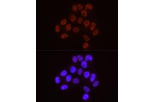 Immunofluorescence analysis of HeLa cells using Phospho-POLR2A CTD-S5 antibody  at dilution of 1:50 (40x lens).