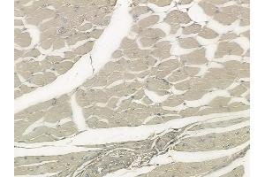 ABIN6265040 and ABIN6273317 at 1/100 staining human tongue carcinoma by IHC-P. (SGCG Antikörper  (C-Term))