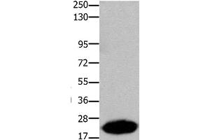 Western Blot analysis of Human liver cancer tissue using Claudin 7 Polyclonal Antibody at dilution of 1:1050 (Claudin 7 Antikörper)