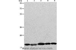 Western blot analysis of Human brain malignant glioma tissue, MCF7, Raji, Lovo and 293T cell, using BAX Polyclonal Antibody at dilution of 1:426 (BAX Antikörper)