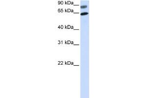 WB Suggested Anti-DVL2 Antibody Titration:  0. (DVL2 Antikörper  (N-Term))