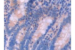Used in DAB staining on fromalin fixed paraffin- embedded testis tissue (Renin Antikörper  (AA 144-237))