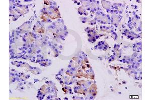 Immunohistochemistry (IHC) image for anti-Sarcoglycan, beta (43kDa Dystrophin-Associated Glycoprotein) (SGCB) (AA 165-260) antibody (ABIN738051)