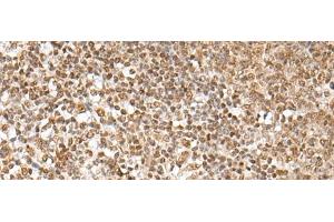 Immunohistochemistry of paraffin-embedded Human tonsil tissue using ZNF354A Polyclonal Antibody at dilution of 1:40(x200) (ZNF354A Antikörper)