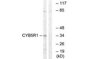 Western blot analysis of extracts from RAW264. (CYB5R1 Antikörper  (AA 9-58))