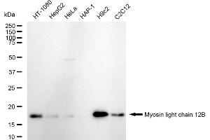 Western blotting analysis using Myosin light chain 12B antibody (ABIN7799527).