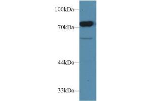 Western blot analysis of Rat Testis lysate, using Rat CD2AP Antibody (1 µg/ml) and HRP-conjugated Goat Anti-Rabbit antibody (