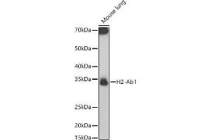 Western blot analysis of extracts of Mouse lung, using H2-Ab1 antibody (ABIN7267665) at 1:1000 dilution. (H2-AB1 Antikörper)