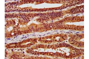 Immunohistochemistry (IHC) image for anti-Casein Kinase 2 alpha 1 (CSNK2A1) (AA 1-391) antibody (ABIN7146885)