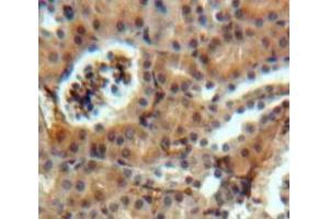 Used in DAB staining on fromalin fixed paraffin-embedded Kidney tissue (SOSTDC1 Antikörper  (AA 24-206))