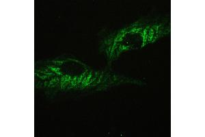 IHC analysis of ATX2 using anti-ATX2 antibody .