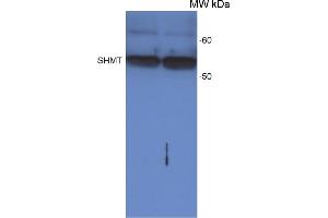 Western Blot detection of SHMT protein in Arabidopsis thaliana leaf extract, loaded on a leaf disc area. (SHMT1 Antikörper)