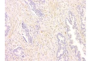 IHC analysis of SRCIN1 using anti-SRCIN1 antibody (ABIN6719623). (SRCIN1 Antikörper  (AA 189-287))