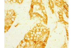 Immunohistochemistry of paraffin-embedded human small intestine tissue using ABIN7159412 at dilution of 1:100 (Meprin B Antikörper  (AA 480-652))