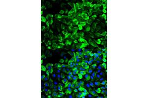 Immunofluorescence analysis of HeLa cells using TPM1 antibody (ABIN2989338). (Tropomyosin Antikörper)
